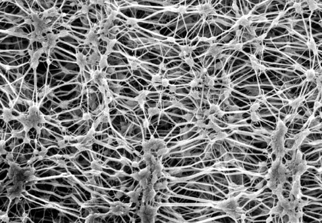 Как выбрать кроссовки для бега зимой 